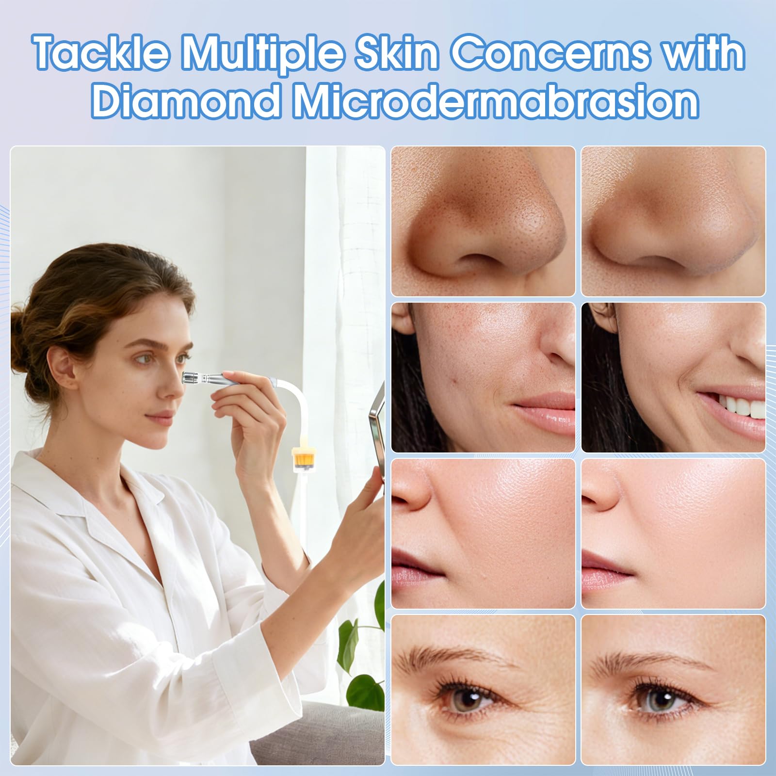 Beauty Star blackhead suction nozzle for clearer pores