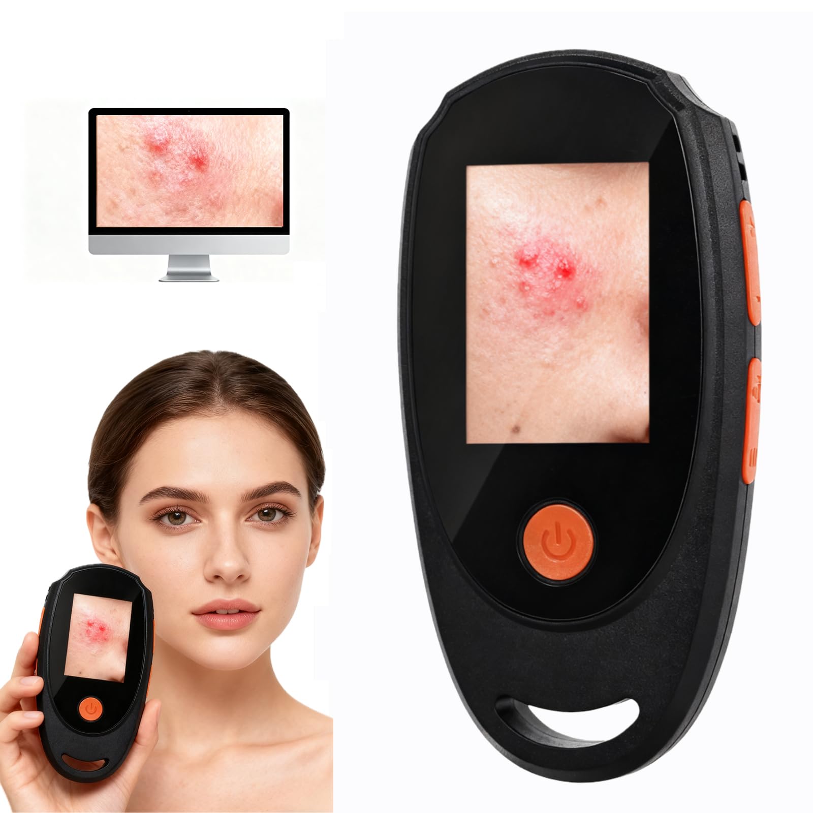 Beauty Star Dermatoscope at 500x magnification for detailed skin texture view