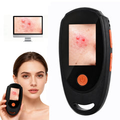 Beauty Star Dermatoscope at 500x magnification for detailed skin texture view