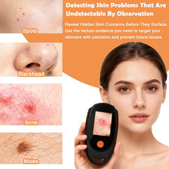 Beauty Star skin camera captures photos and videos for on-device records