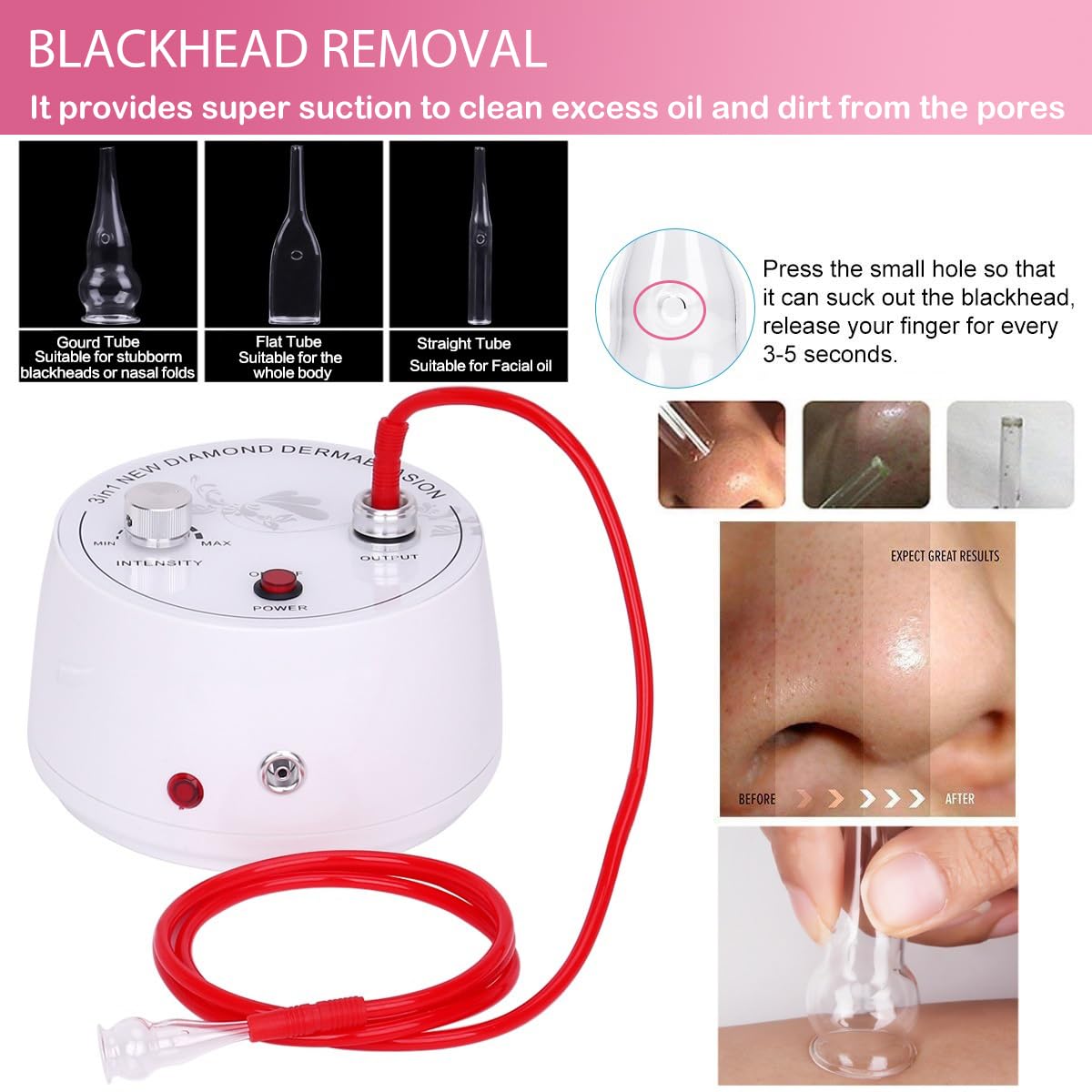 Beauty Star vacuum suction function for stable, controlled treatment