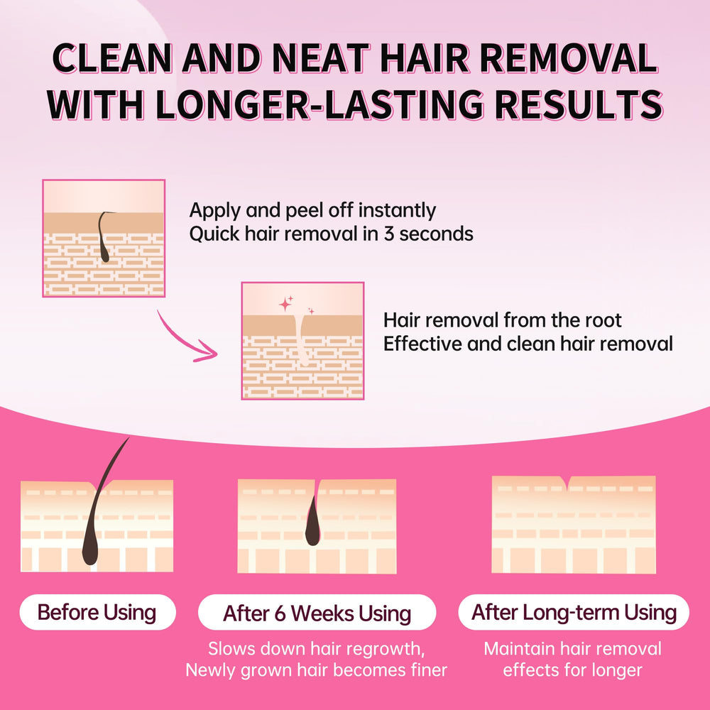Beauty7 Hair removal action demonstrates lifting hair from the root