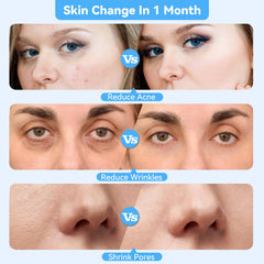 Beautycity optimized absorption enhances serum penetration for clearer skin.
