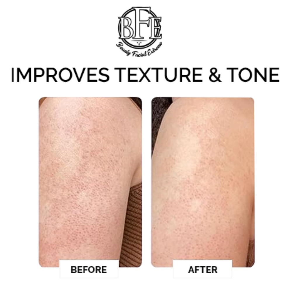 Beauty Facial Extreme kp lotion with ceramides focuses on dry elbows and knees.