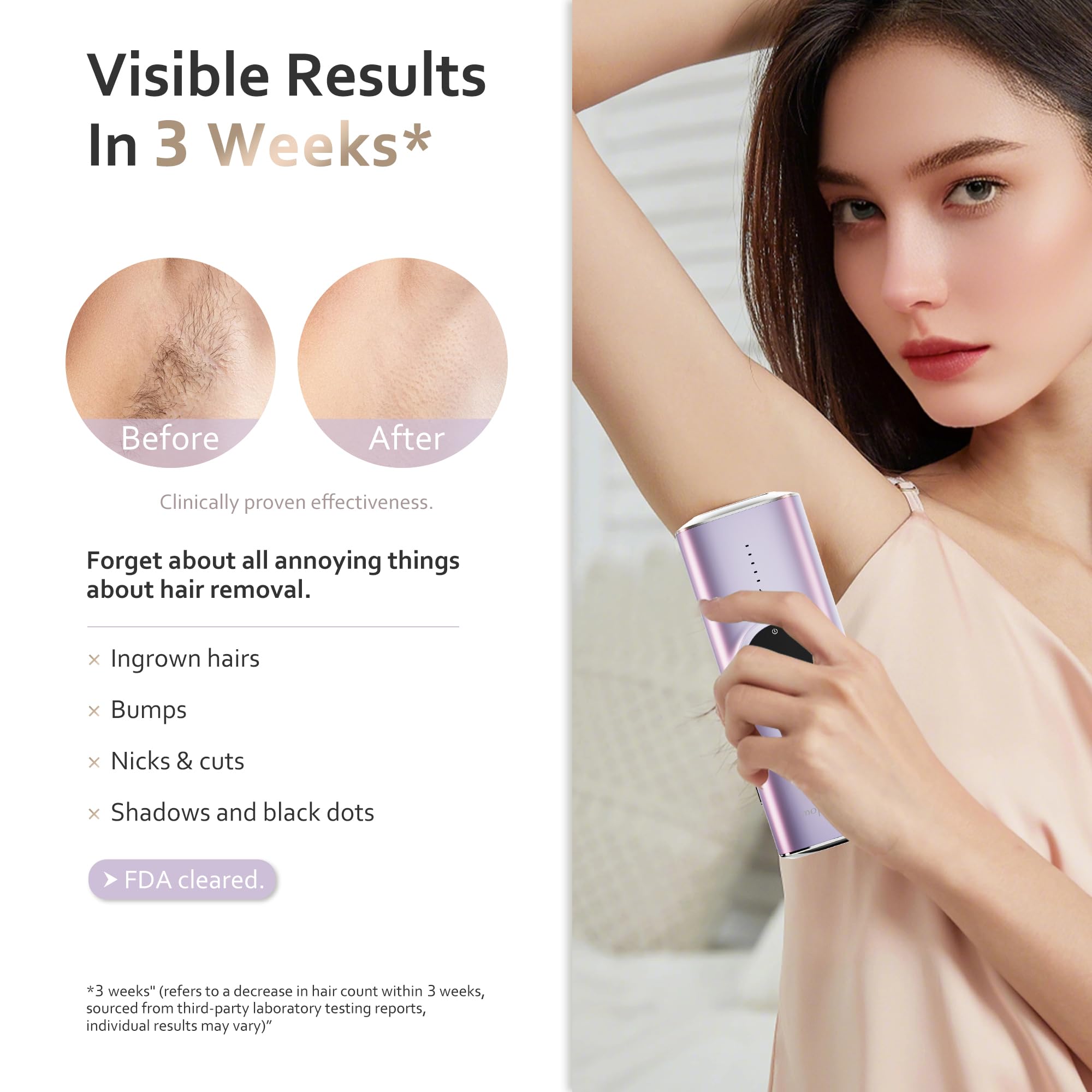 BeautyGlow underarm hair removal with IPL technology