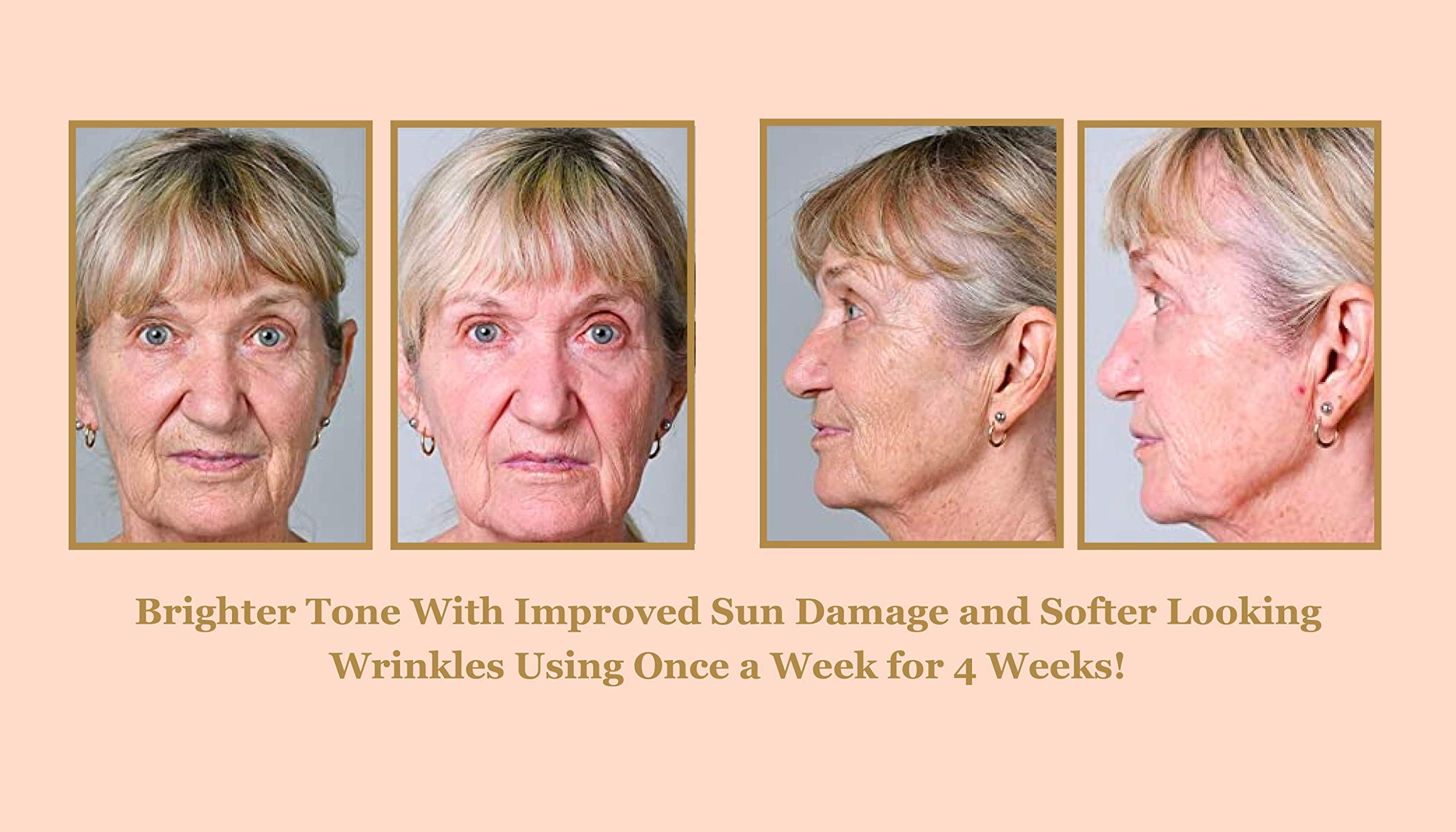 Bee Stunning Diamondbuff around eye area showing gentle exfoliation