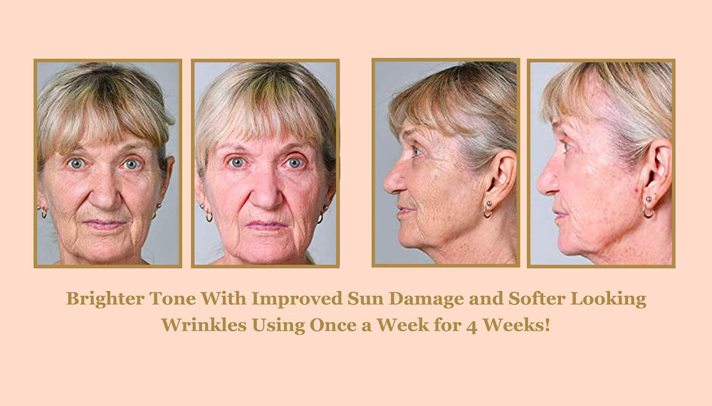 Bee Stunning Diamondbuff around eye area showing gentle exfoliation