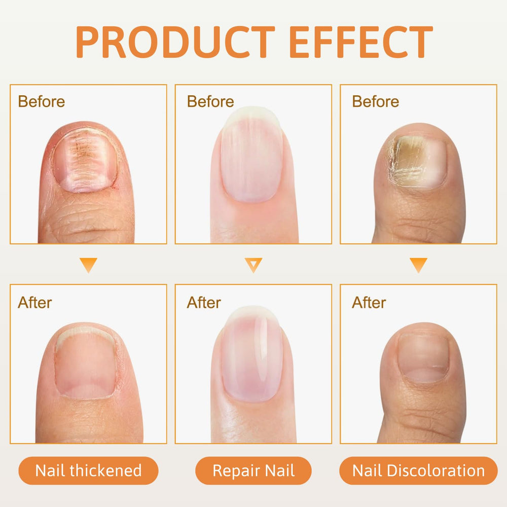Bee Venom Nail Spray being applied to nails; easy absorption