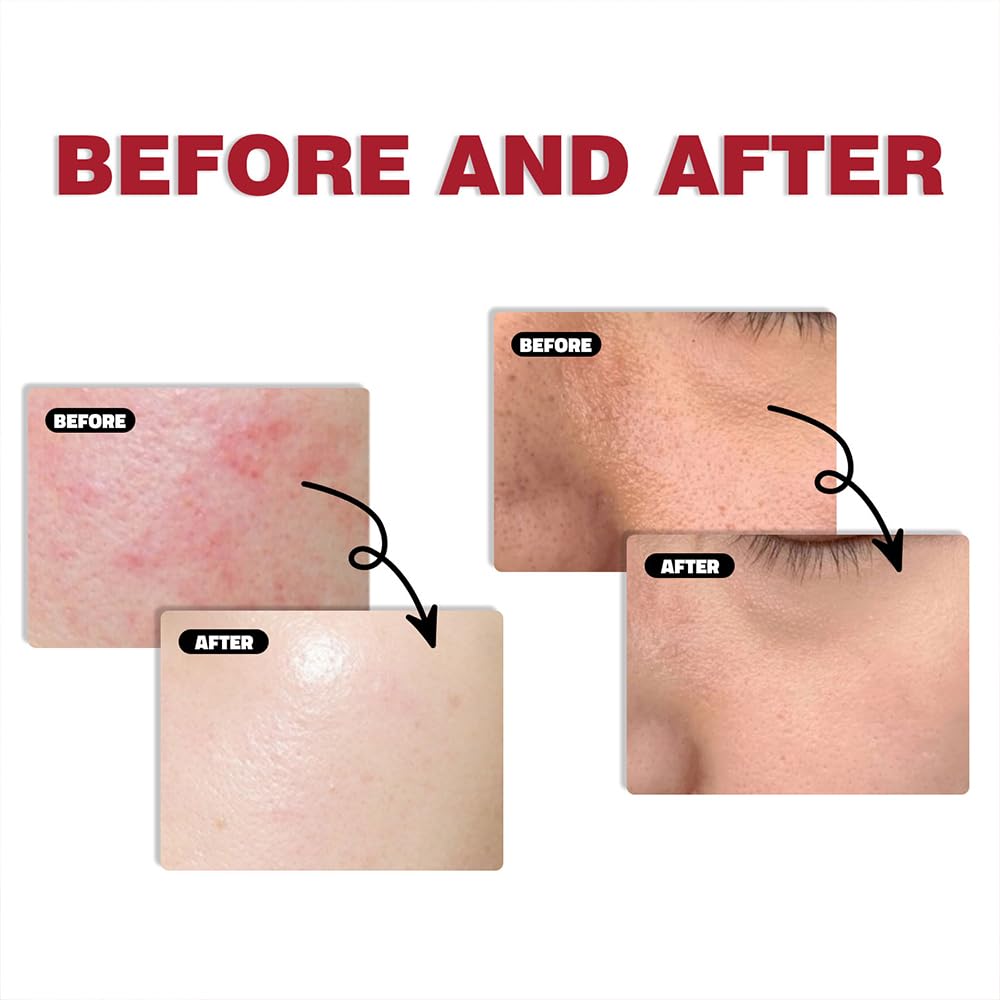 Outdoor use with Beef Tallow Sunscreen during a sunny hike