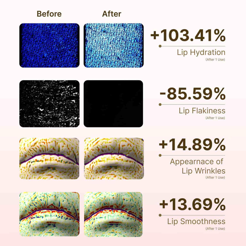 Beenuvo Honey & Collagen Lip Butter ideal for sensitive lips and daily care.