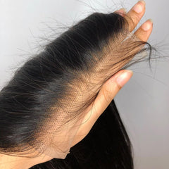 BEEOS closure close-up with bleached knot and natural hairline for realism and seamless blend.