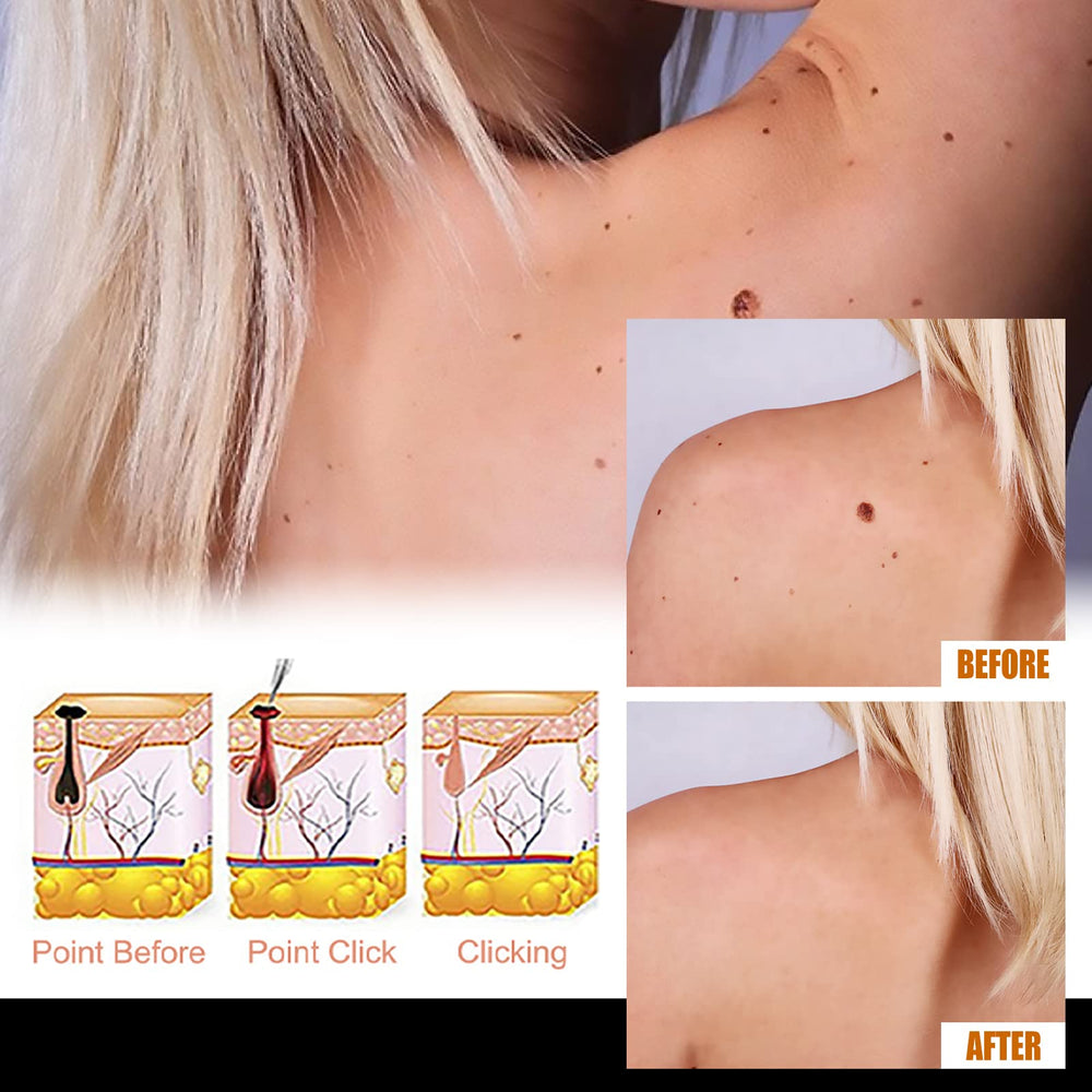 Befada glycerin hydration formula helps maintain moisture during use.