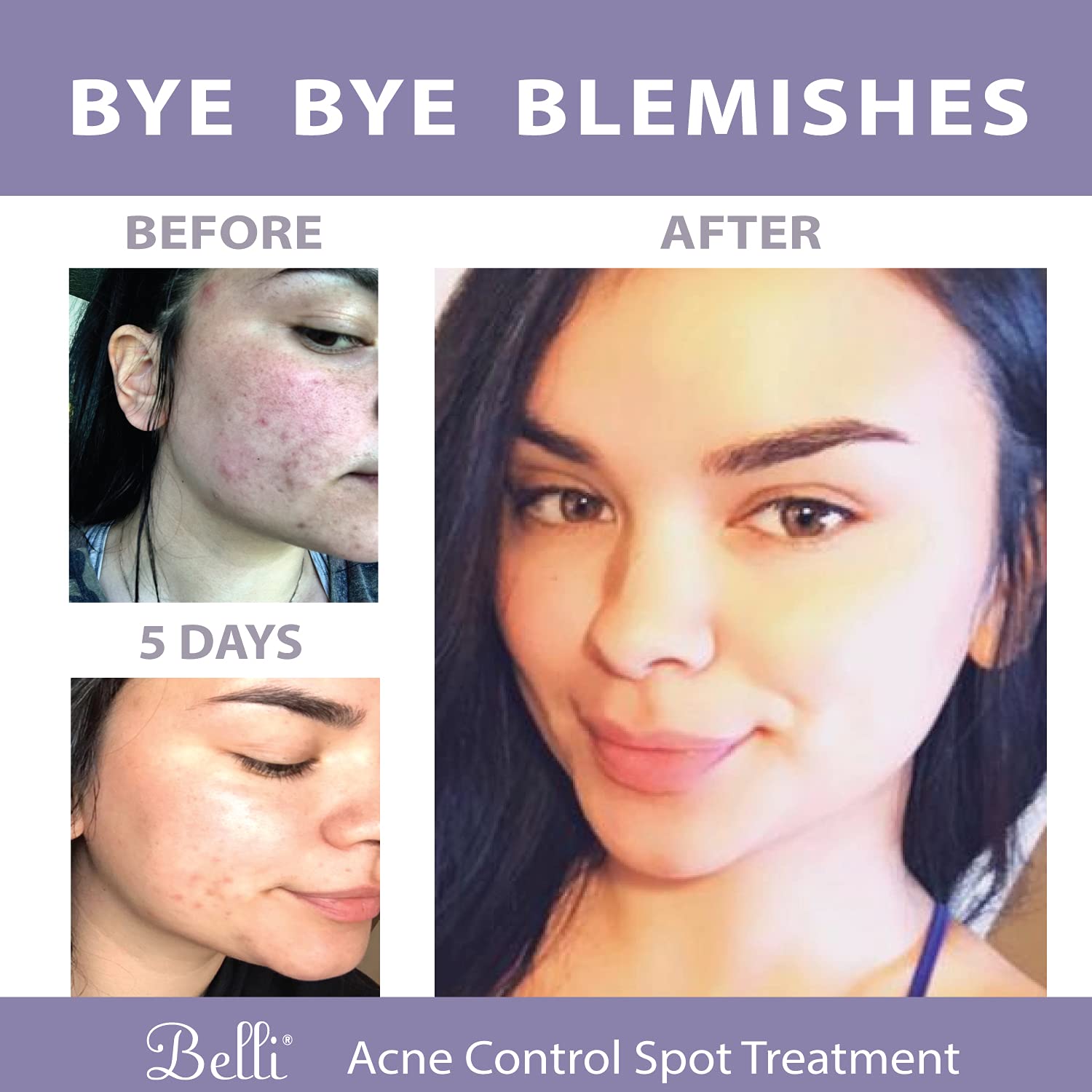 Belli pregnancy-safe skincare label emphasizing allergy-tested formula.