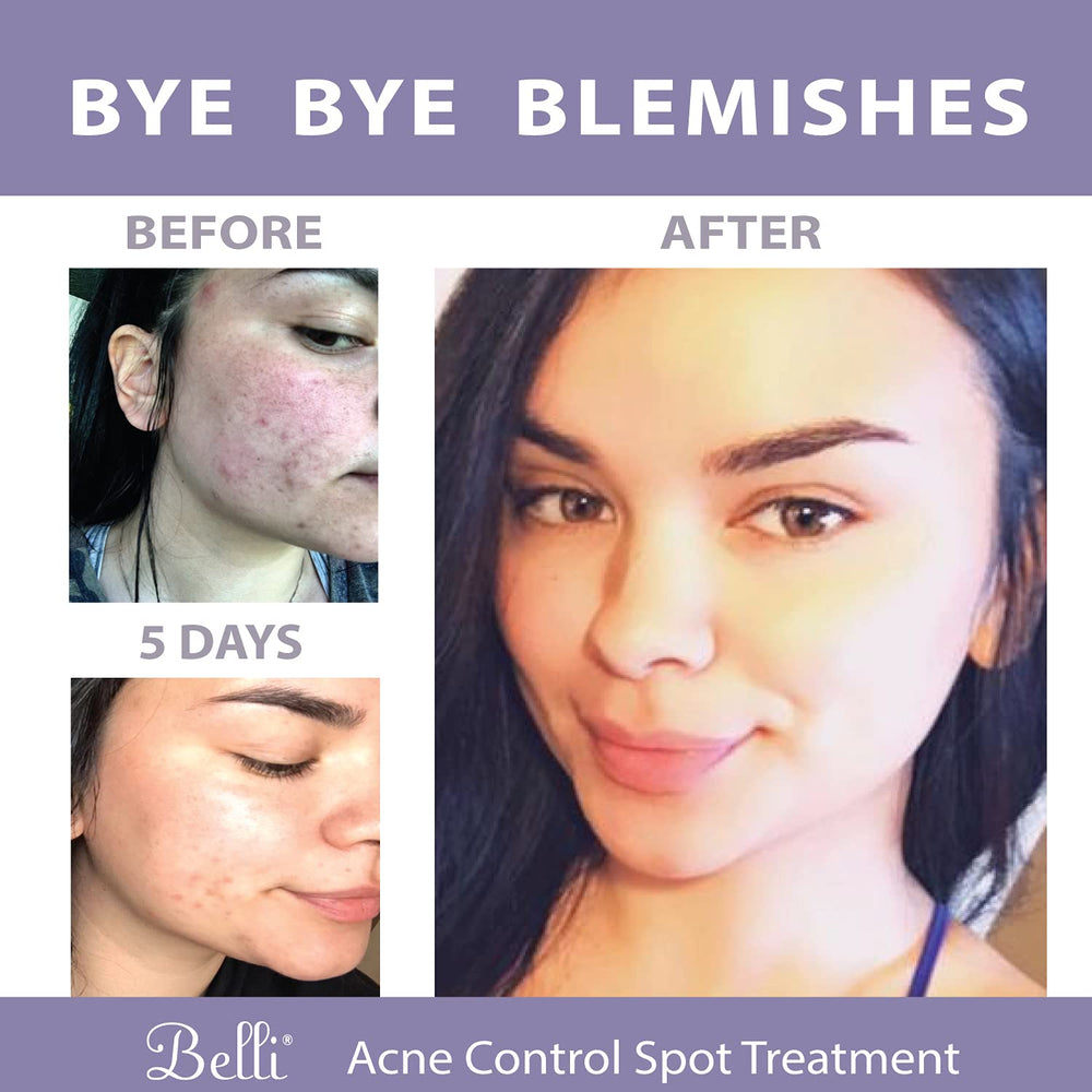 Belli pregnancy-safe skincare label emphasizing allergy-tested formula.