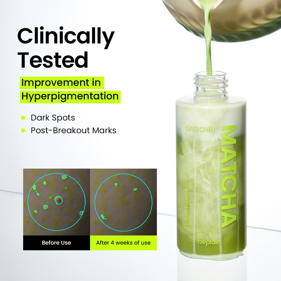 beplain Matcha Catechin Essence ceramide milk supporting moisture barrier