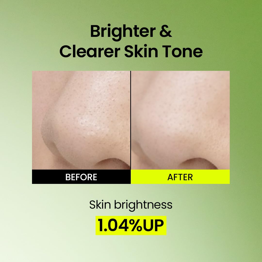 Rinse reveals smoother skin with refined pores after Beplain mask.