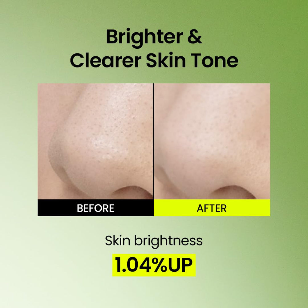 Rinse reveals smoother skin with refined pores after Beplain mask.