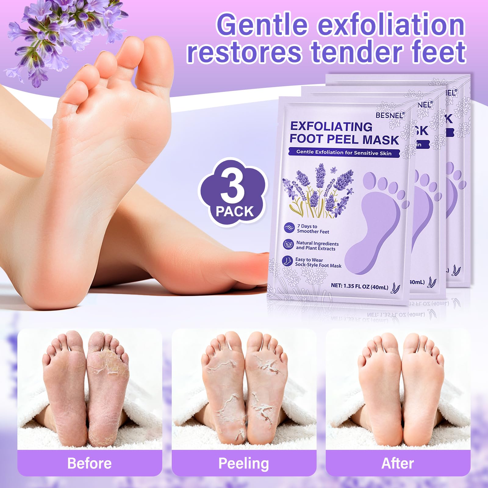 Besnel moisturizing foot mask applied for hydration and soft, crack-free heels.