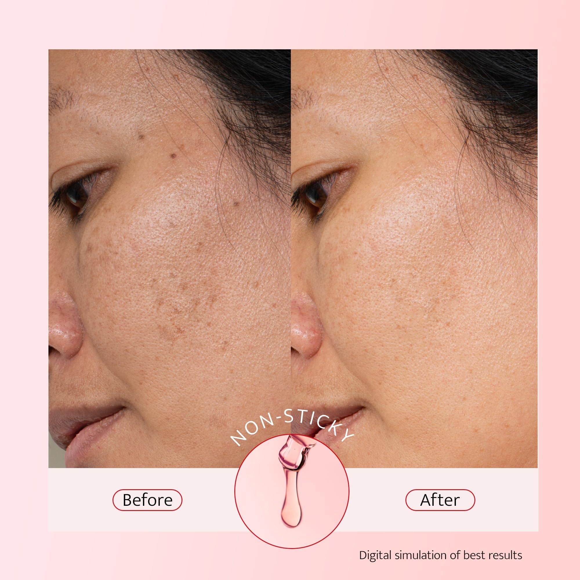 Bestkiss alpha-arbutin even-tone focus image illustrating reduction of visible dark spots.