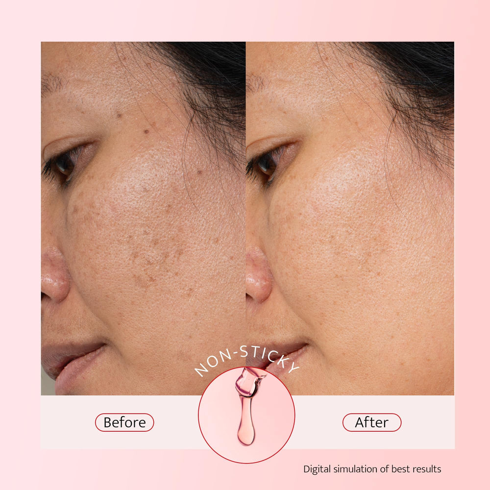Bestkiss alpha-arbutin even-tone focus image illustrating reduction of visible dark spots.