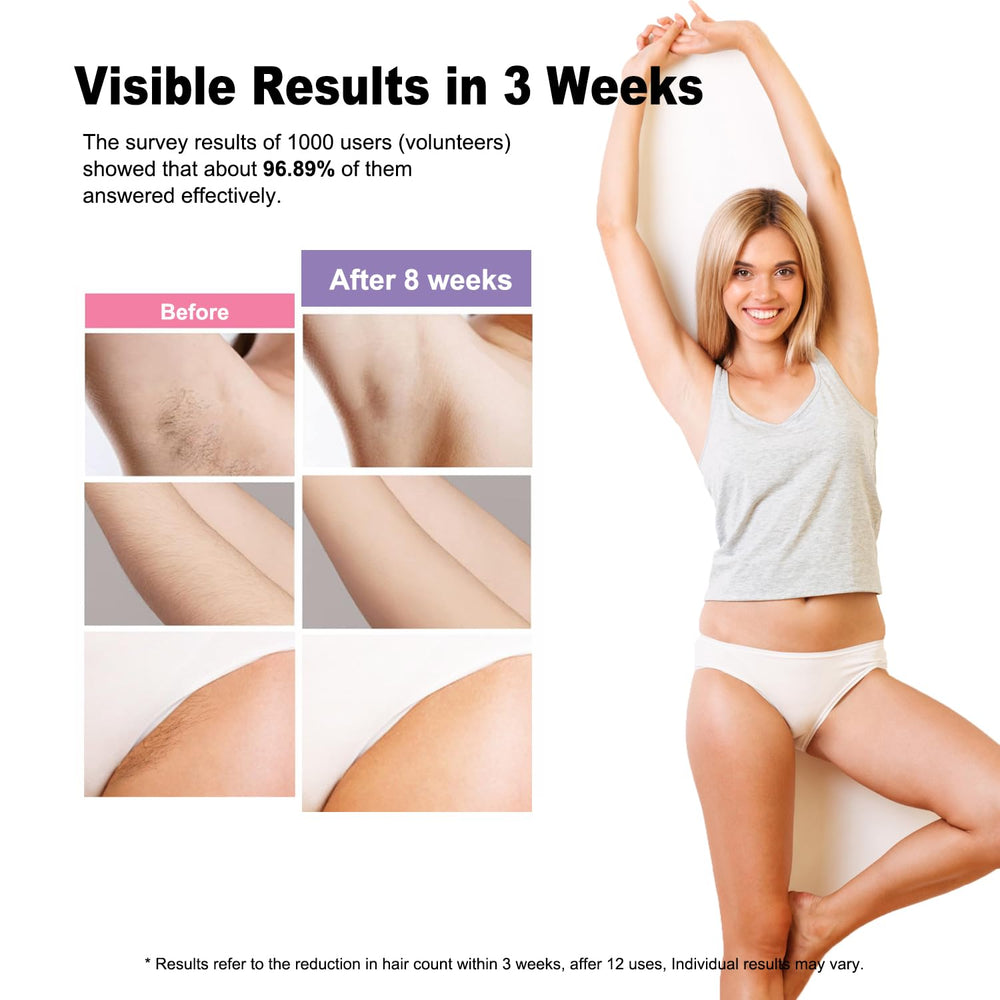 BETNEP IPL device full-body treatment ideal for home sessions.