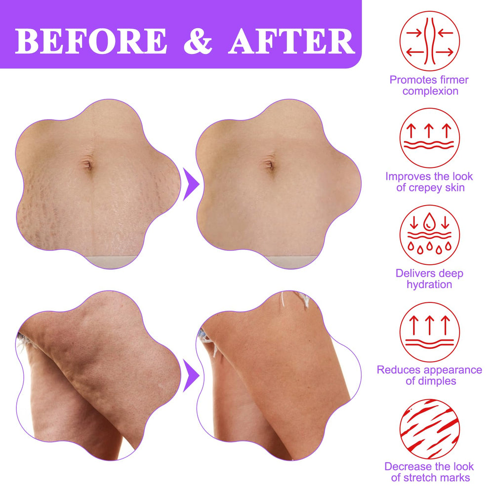 BETTENKO crepey skin hydration demonstrates deep moisture and softness.