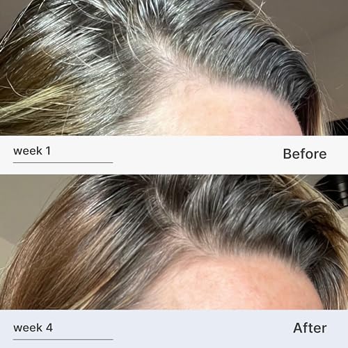 Better Not Younger ginger-centella essence highlights plant-based formula.