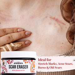 Better Shea Butter Scar Eraser Balm ingredients photo showcases cocoa and shea oils.
