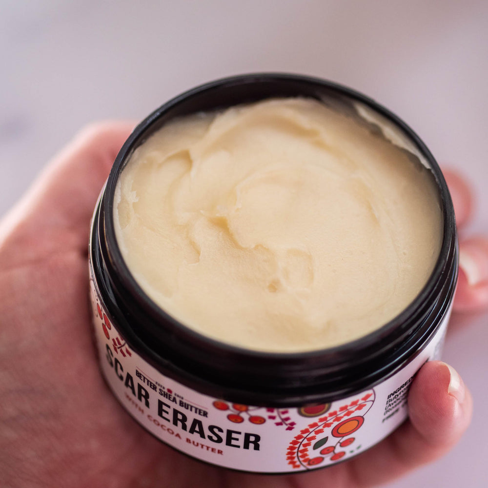 Better Shea Butter Scar Eraser Balm jar highlights rich texture for deep moisturization.