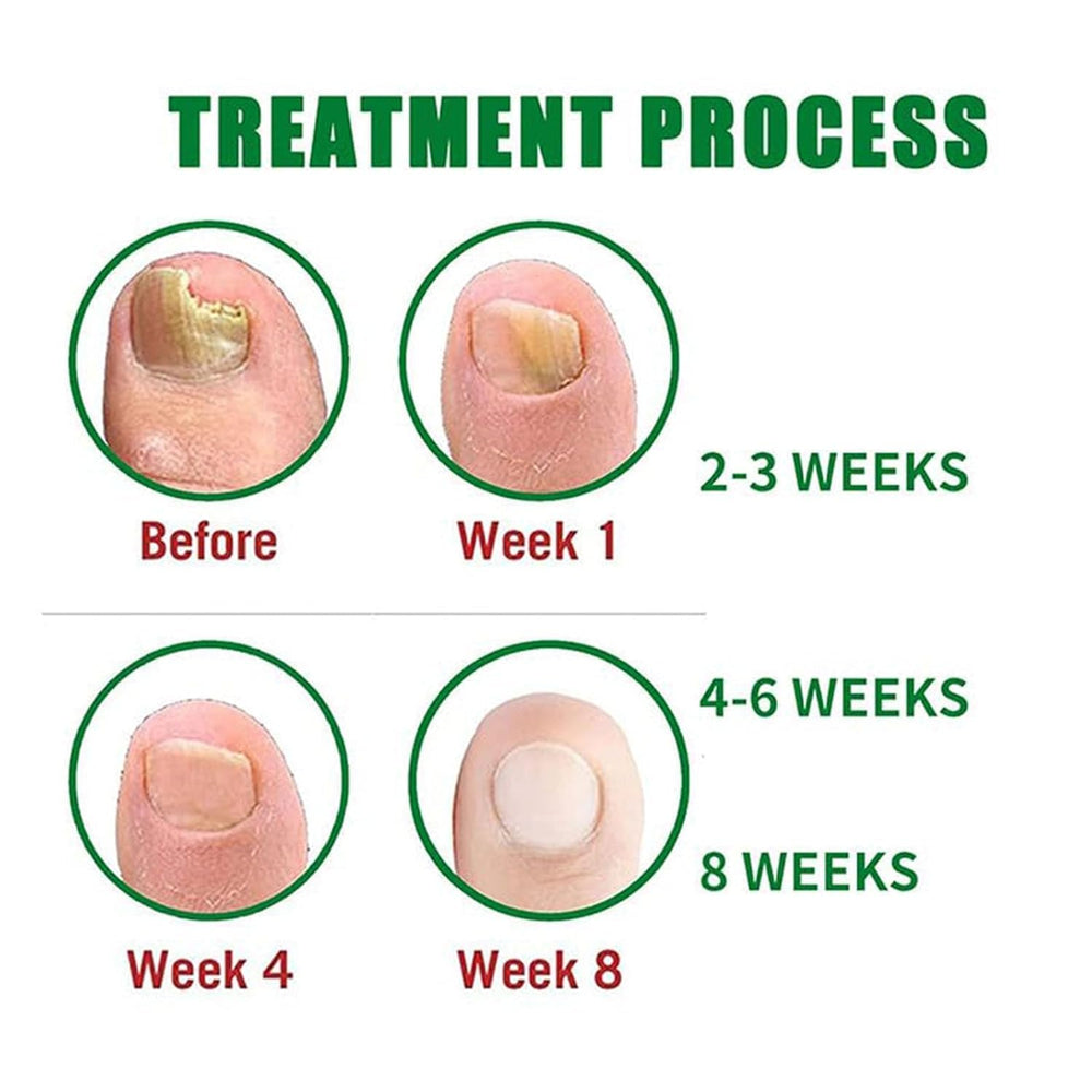 Beuifvo Deep Moisturizing Nail Care Gel delivers lasting hydration.