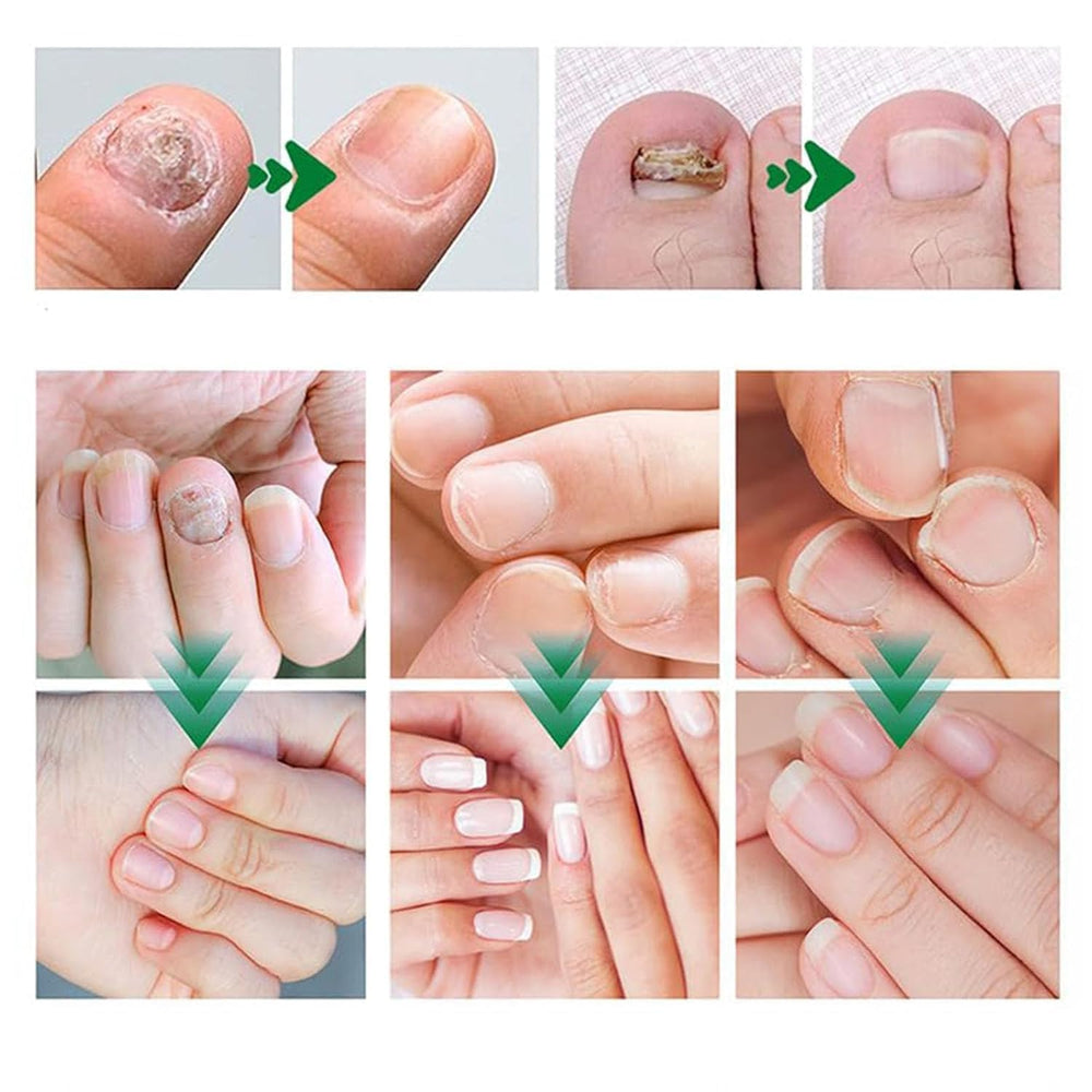 Beuifvo Nail Growth Serum helps strengthen and support healthy-looking nails.