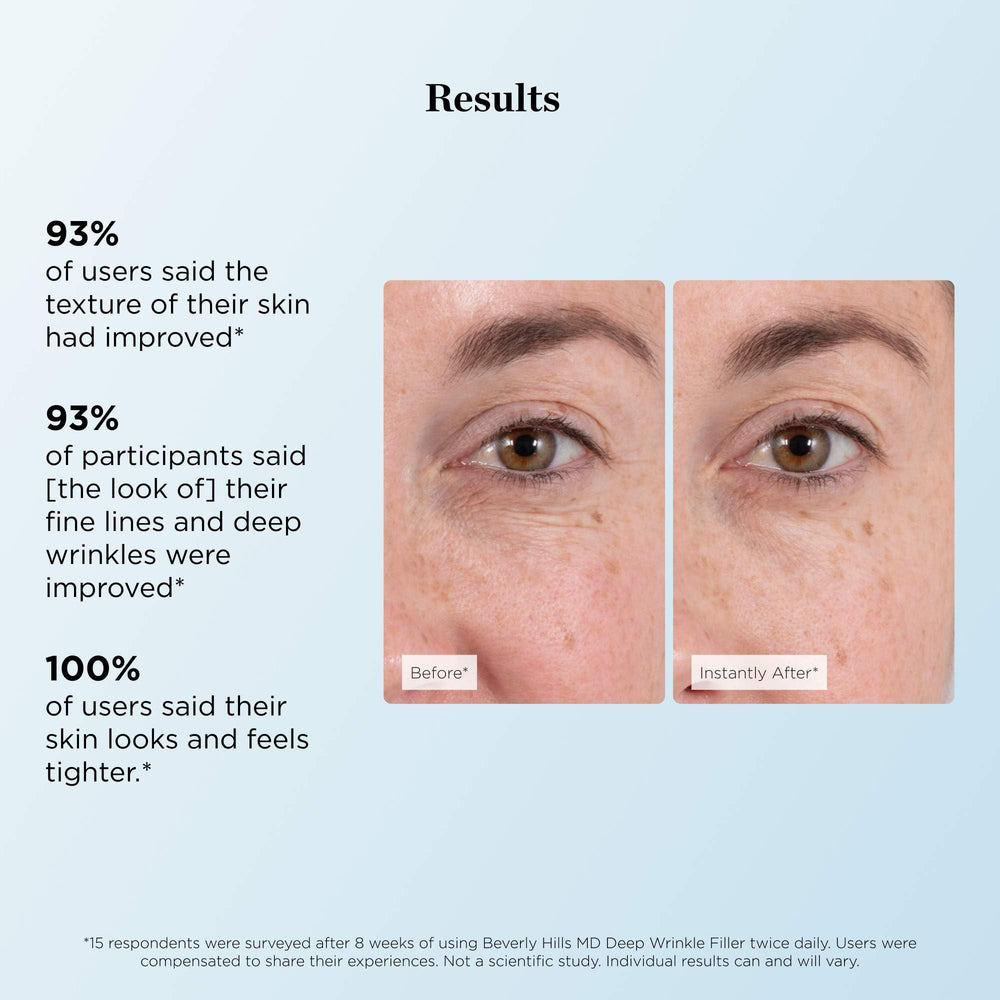 Beverly Hills MD Deep Wrinkle Filler featuring Tightenyl for a firmer look