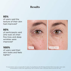 Beverly Hills MD Deep Wrinkle Filler featuring Tightenyl for a firmer look