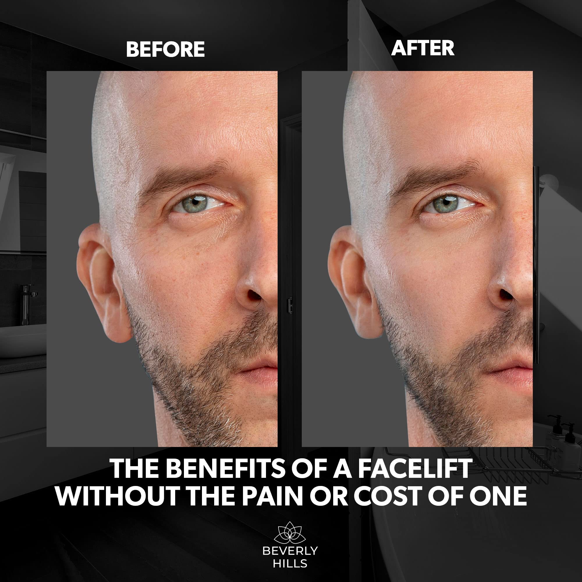 BEVERLY HILLS MENS UNDER-EYE AREA CLOSEUP with reduced sagging look