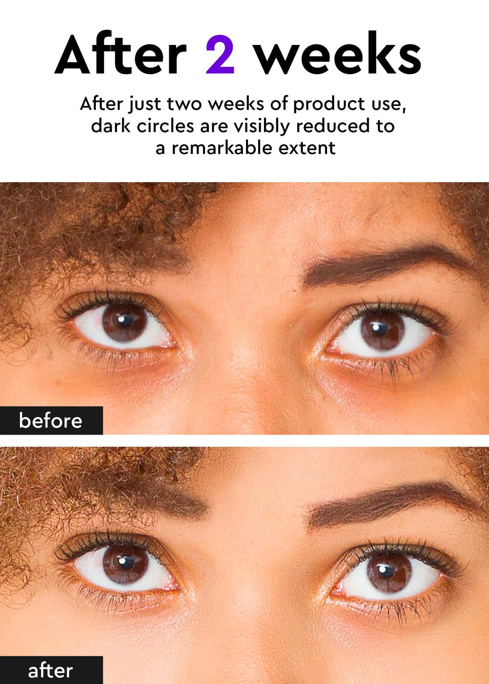 BE+WANTS hypoallergenic formula soothes sensitive skin around the eyes.