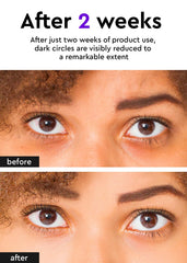 BE+WANTS hypoallergenic formula soothes sensitive skin around the eyes.