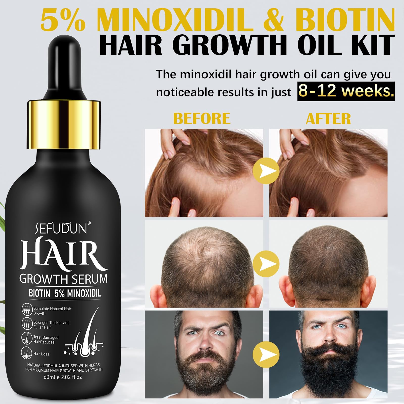 Bieyoc Minoxidil Growth Serum dropper ready for precise scalp application.