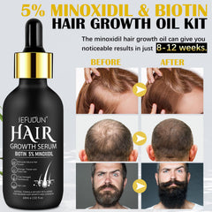 Bieyoc Minoxidil Growth Serum dropper ready for precise scalp application.