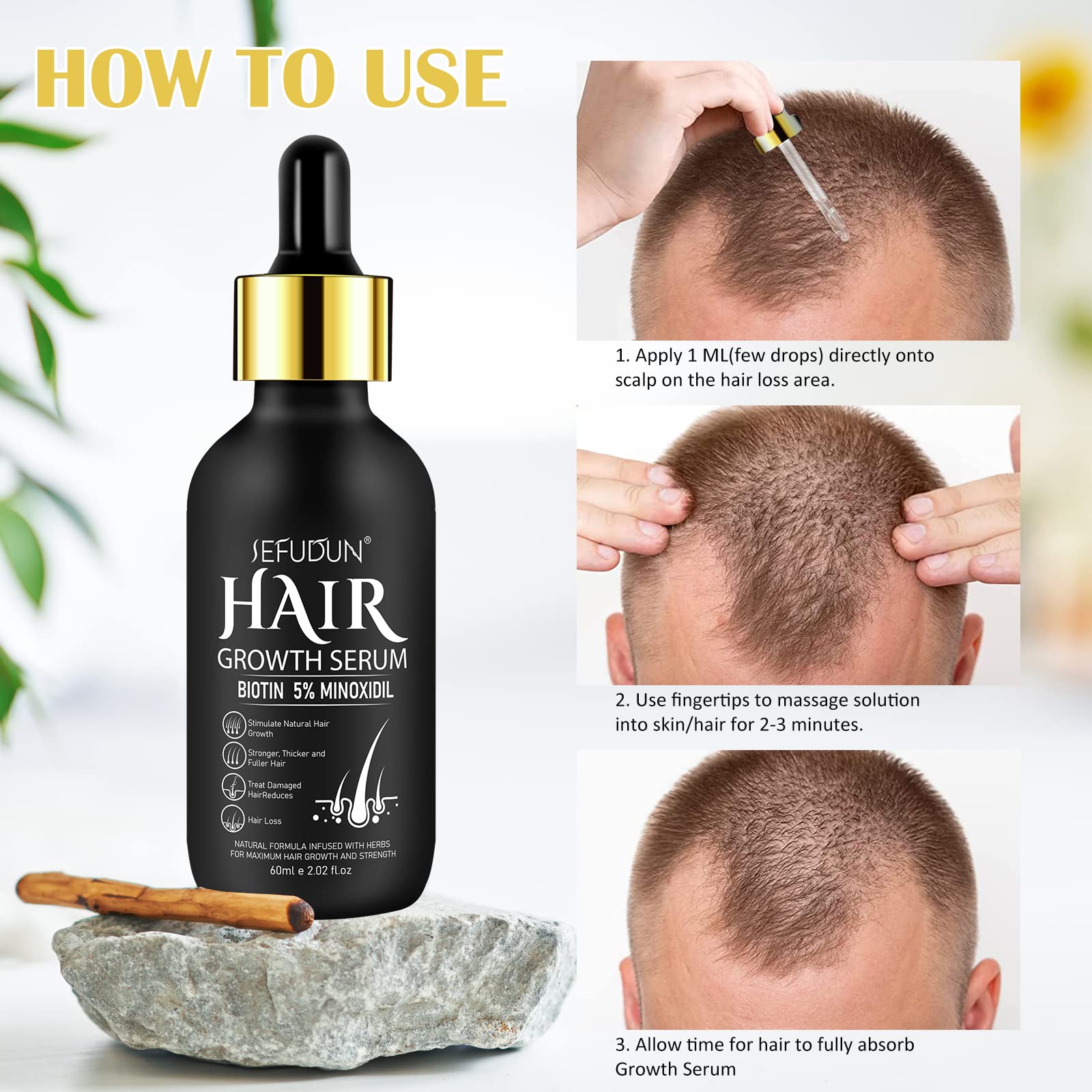 Bieyoc Minoxidil Growth Serum closeup on hair showing potential thickening.