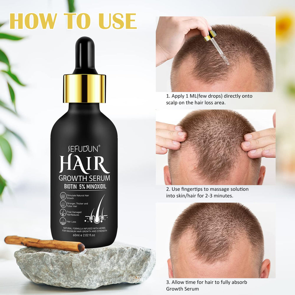 Bieyoc Minoxidil Growth Serum closeup on hair showing potential thickening.