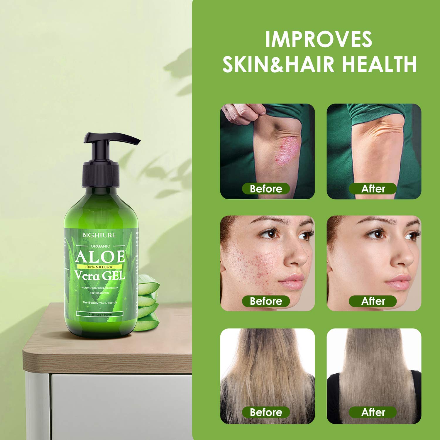 After shaving, BIGHTURE Aloe Vera Gel calms razor burn effectively.