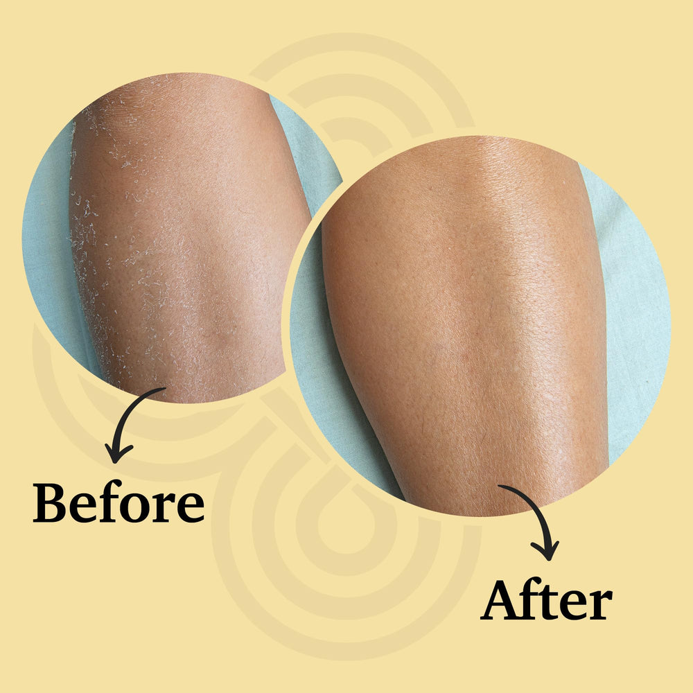 Bioactive Skin Rescue The Melting Balm shows rosehip oil benefits on skin