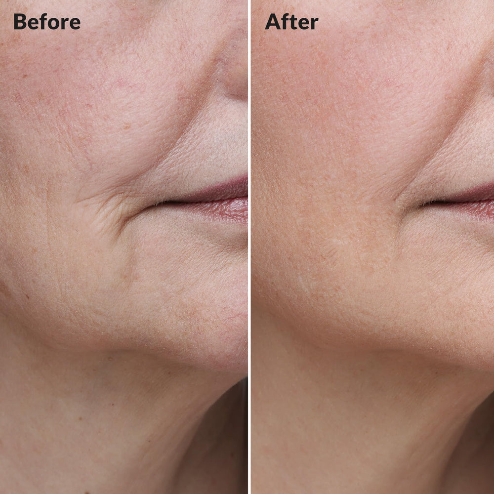 BIOCHEM Hyaluronic Acid formula provides lasting moisture.