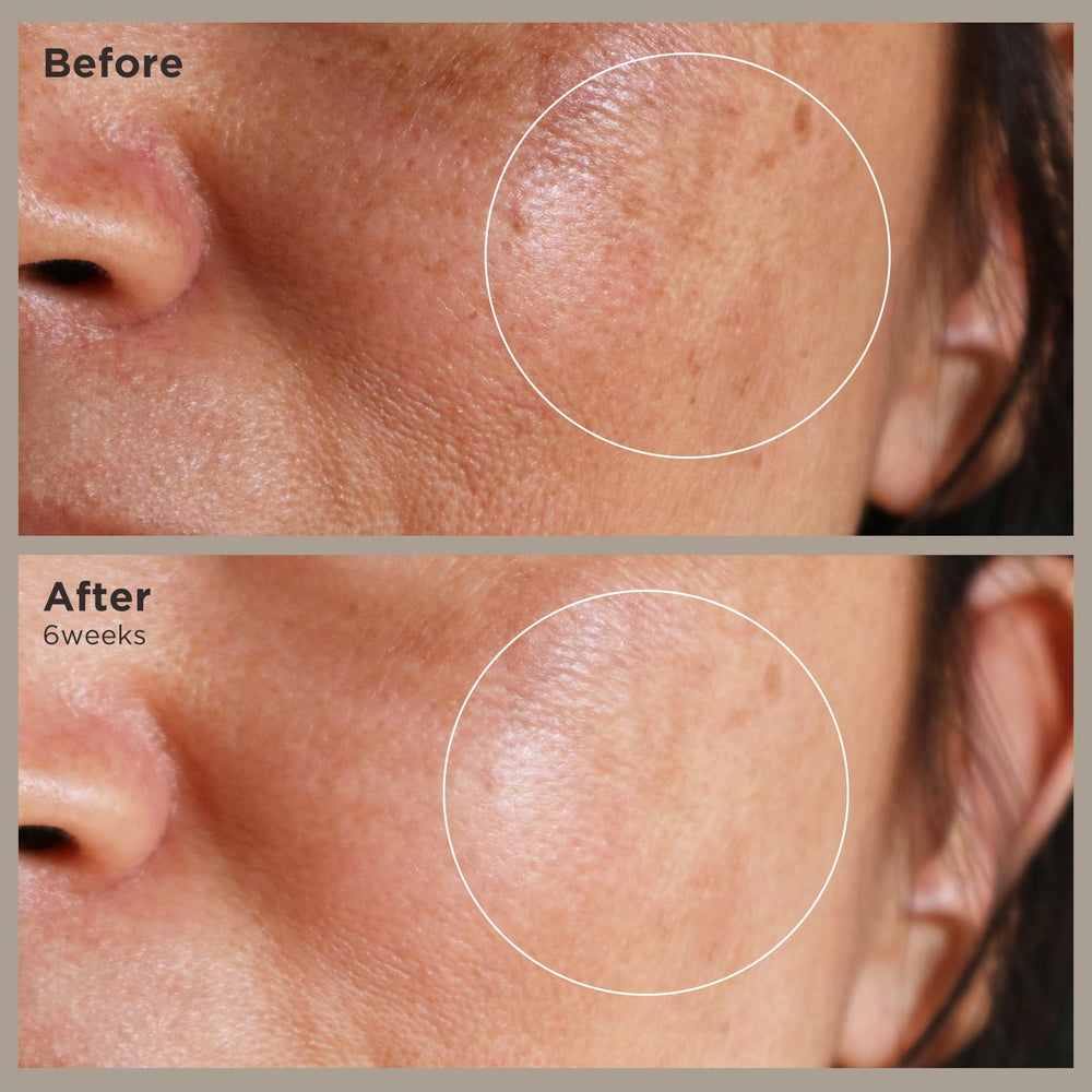 BIOCHEM Nonapeptide-1 bottle beside moisturizer underscores layering versatility
