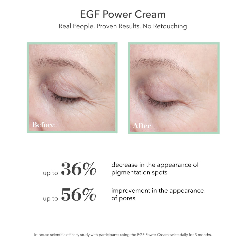 Bioeffect EGF Power Cream neck application in a lifting routine.