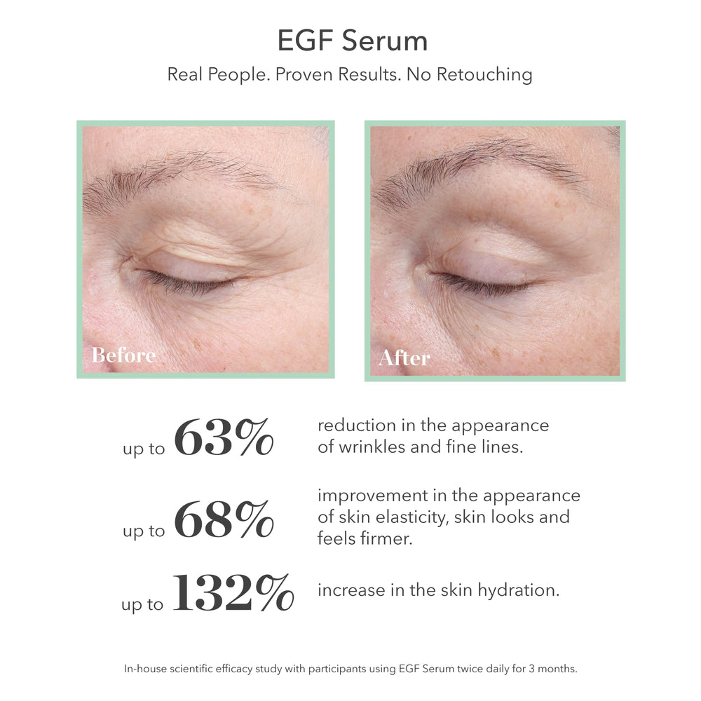 Bioeffect EGF Serum glass bottle with icy Iceland imagery signaling purity and clean beauty