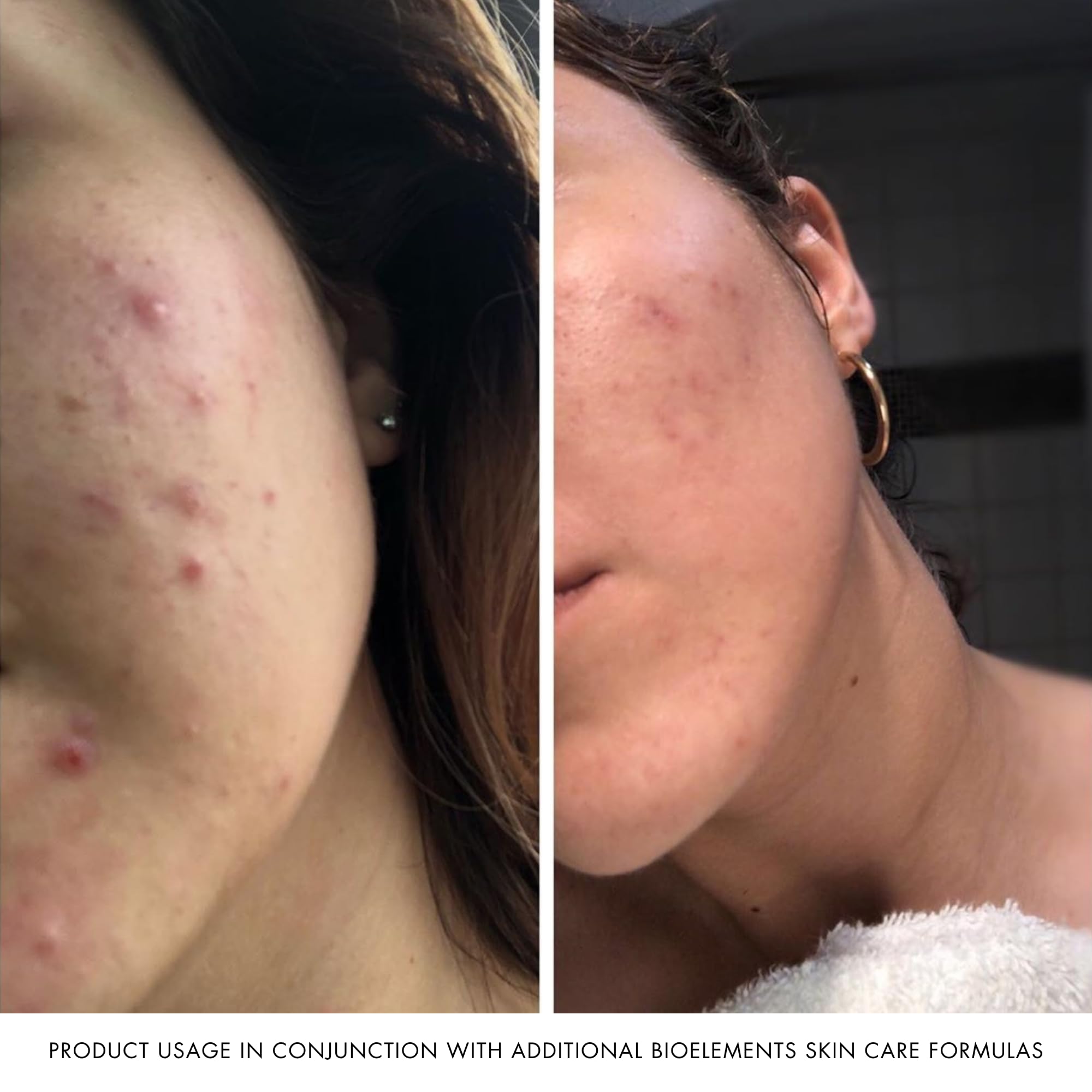 Bioelements Power Peptide Toner on skin showing light hydration and prep for moisturizer