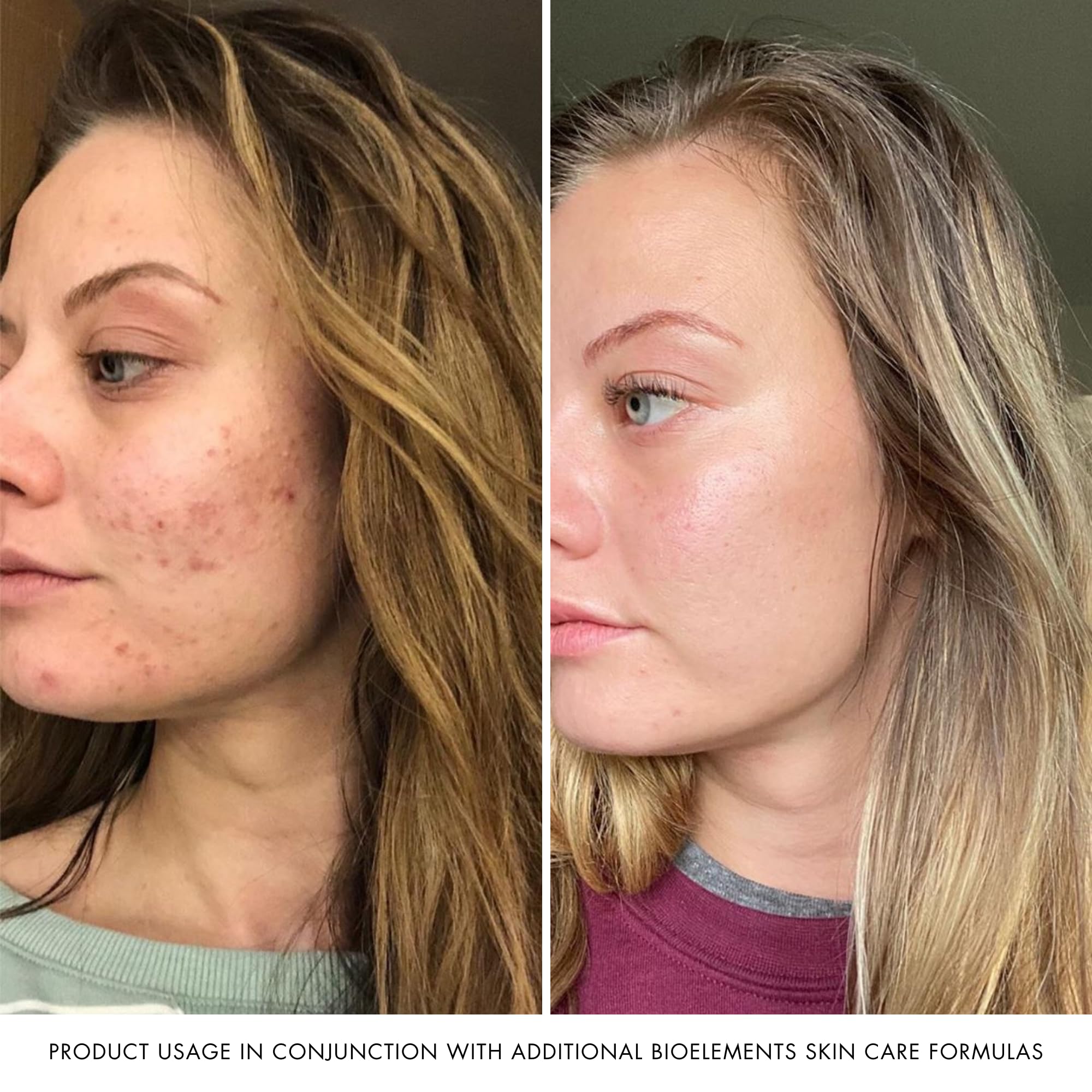 Bioelements RayDefense SPF 30 on skin for daily outdoor protection.