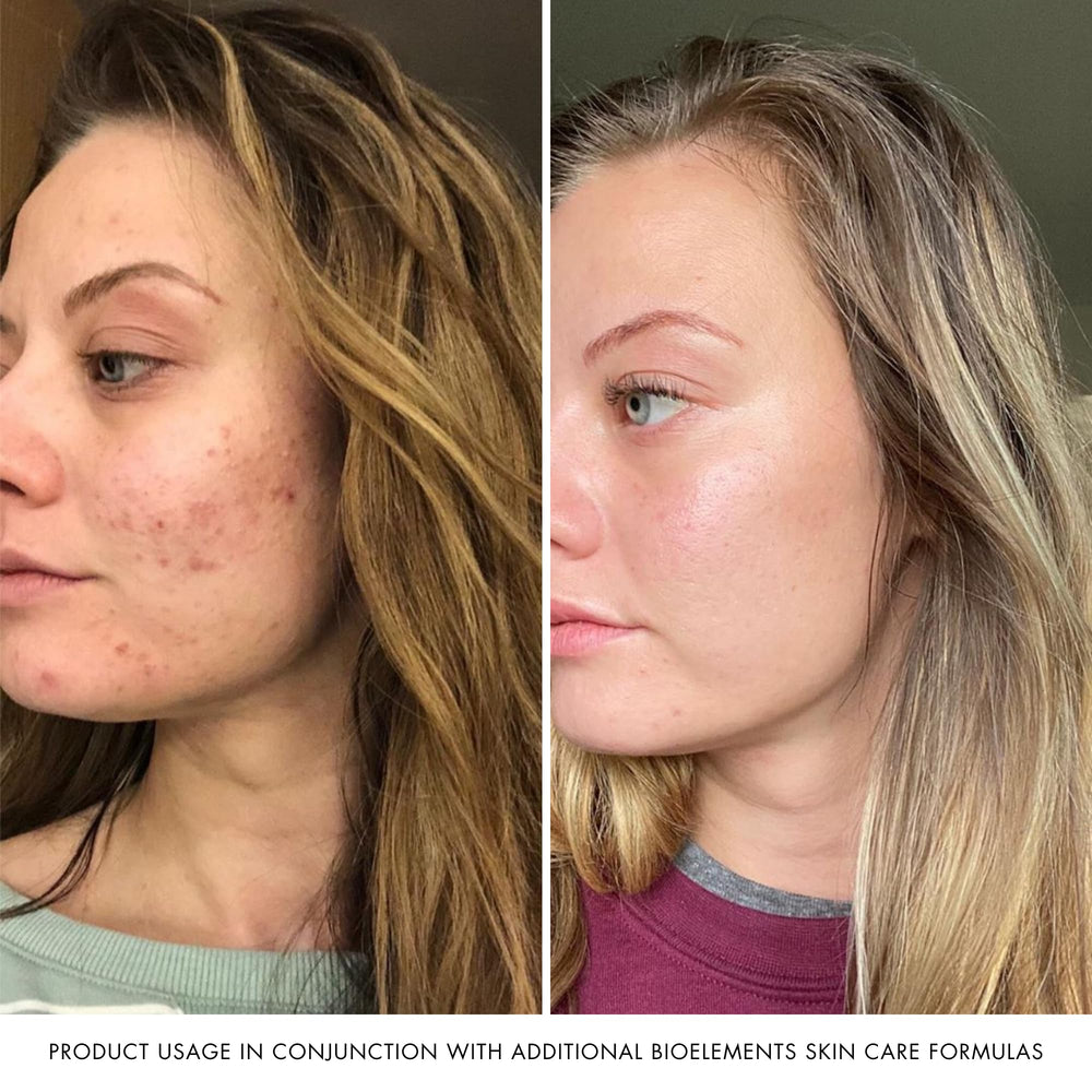 Bioelements RayDefense SPF 30 on skin for daily outdoor protection.