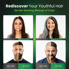 BIOGREEN ROOTS herbal blend with ginger and ginseng for nourished hair care.